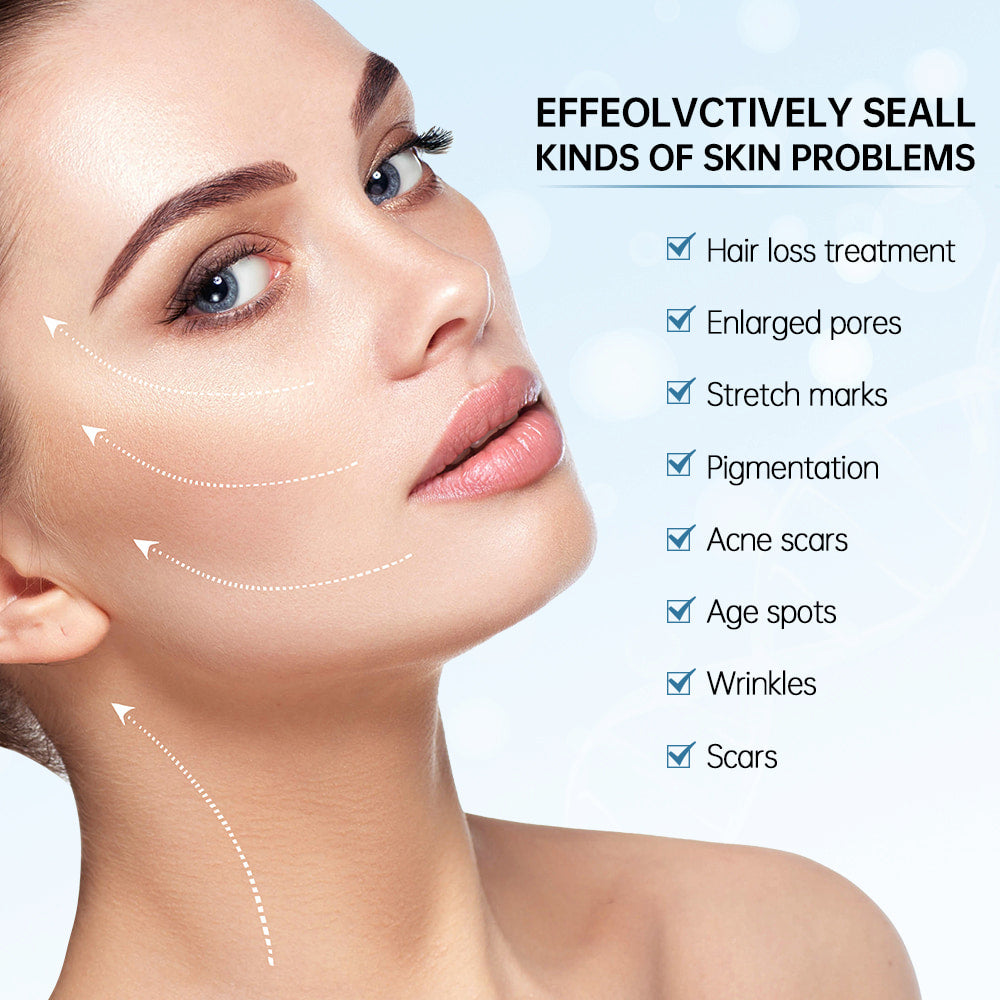 Žena, ktorá ukazuje výsledky microneedling na liečbu kožných problémov, ako sú veľké póry, jazvy, jazvy po akné, pigmentové škvrny, vrásky a jemné linky.