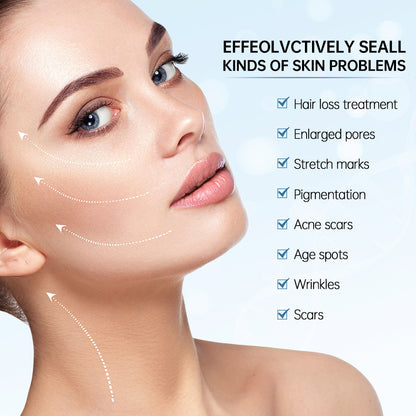 Žena, ktorá ukazuje výsledky microneedling na liečbu kožných problémov, ako sú veľké póry, jazvy, jazvy po akné, pigmentové škvrny, vrásky a jemné linky.